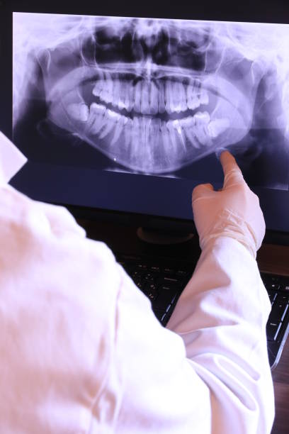 Best Knocked-Out Tooth (Avulsed Tooth) Treatment in Clarkton, MO